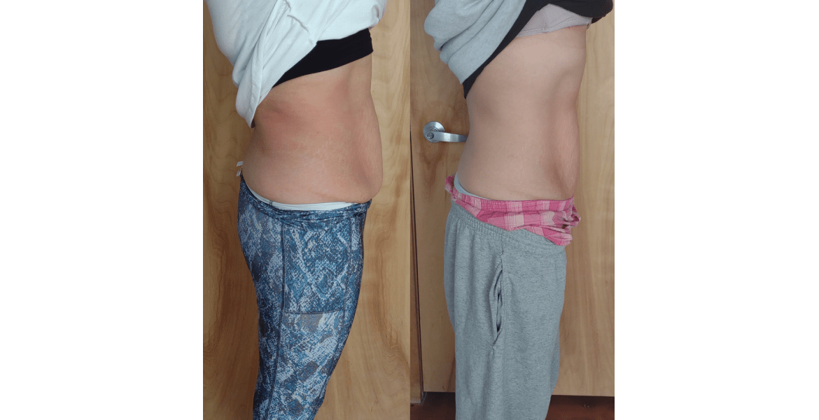 CryoSculpt